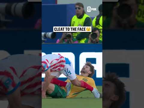 A scary incident for Australia's Connor Metcalfe 🇦🇺
