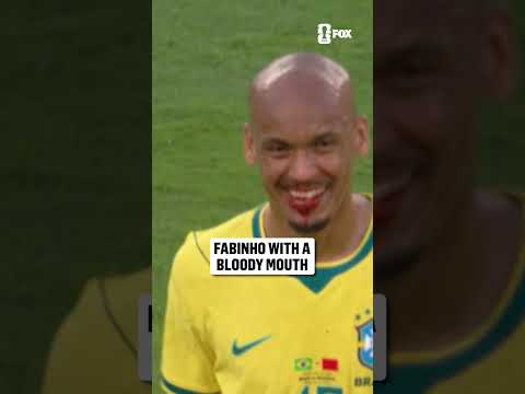 Fabinho was all smiles after being bloodied