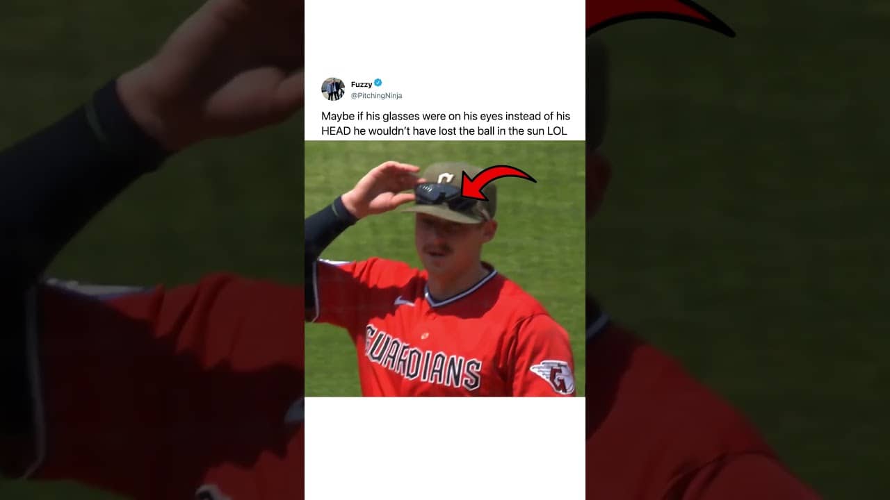why were they on his head... 🤔