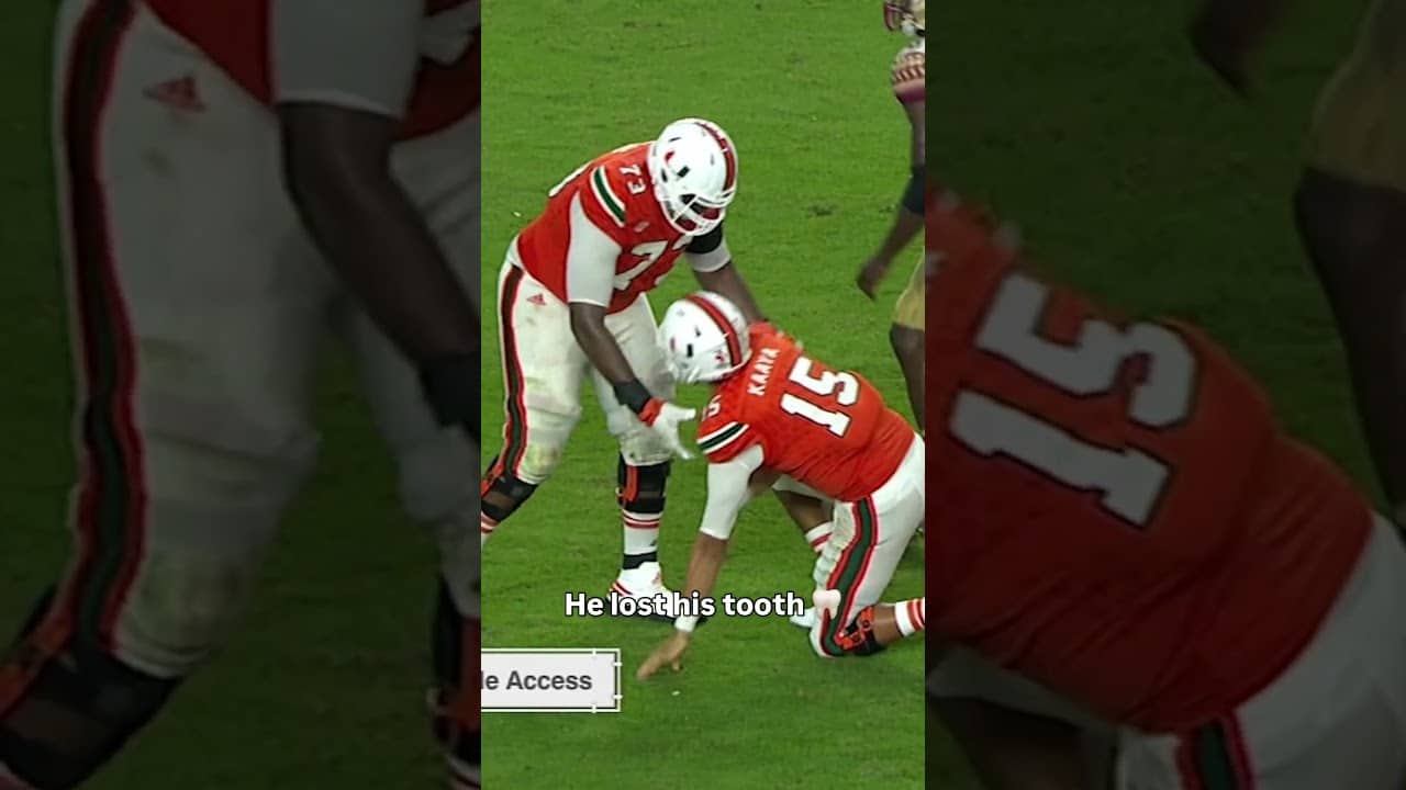 The tooth was recovered 😅 #miamihurricanes #accfootball #collegefootball