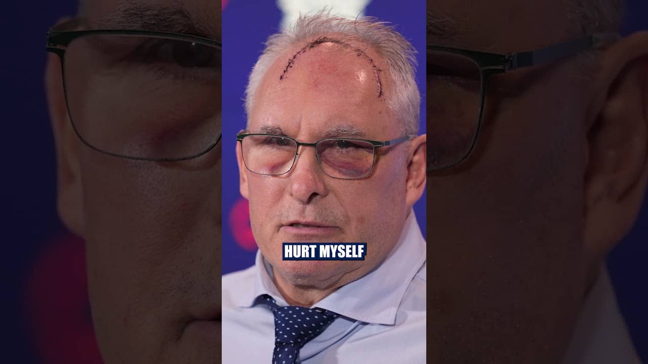 Craig Berube Shares New Details on the Weight Room Accident